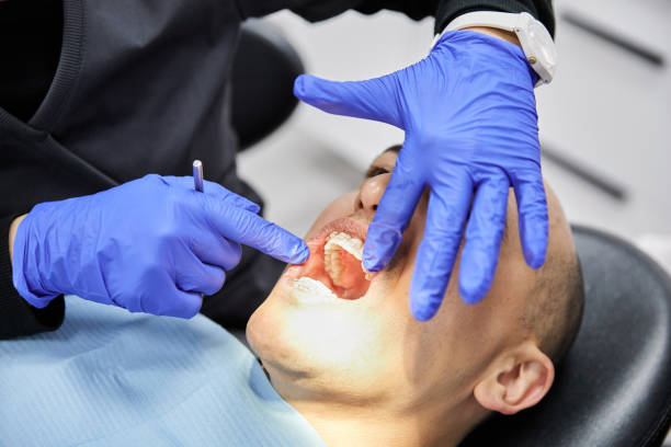 Best Emergency Wisdom Teeth Removal in Lucas, TX